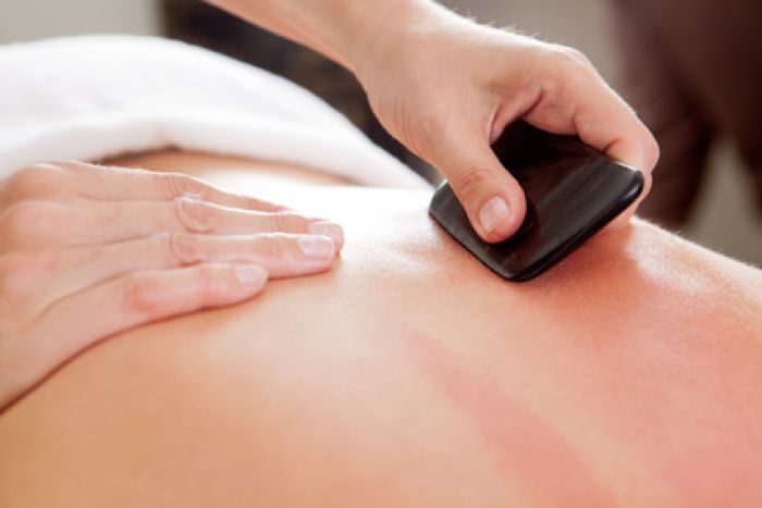 Gua Sha nach TCM